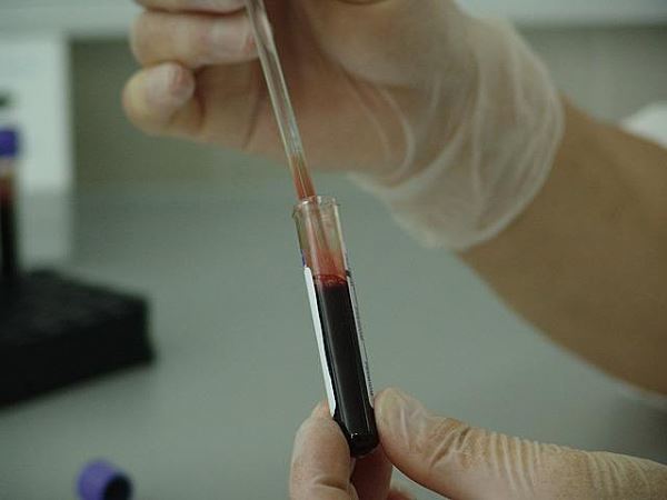 Может ли у человека измениться группа крови или резус-фактор